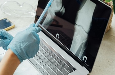 Na ekranie laptopa wyświetla się zdjęcie rentgenowskie kości. Lekarz pokazuje wskaźnikiem miejsca chorobowe.